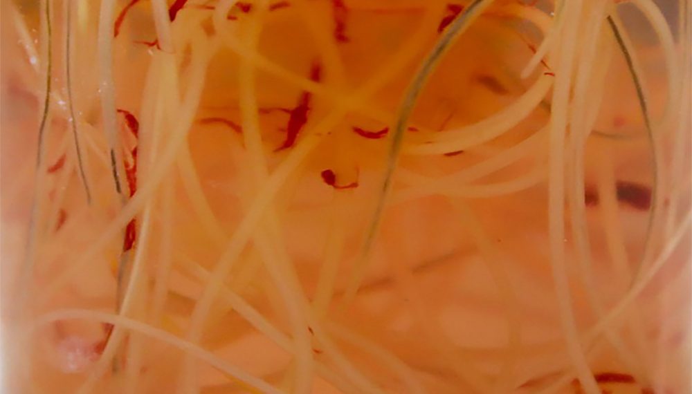 Parásitos a la vista